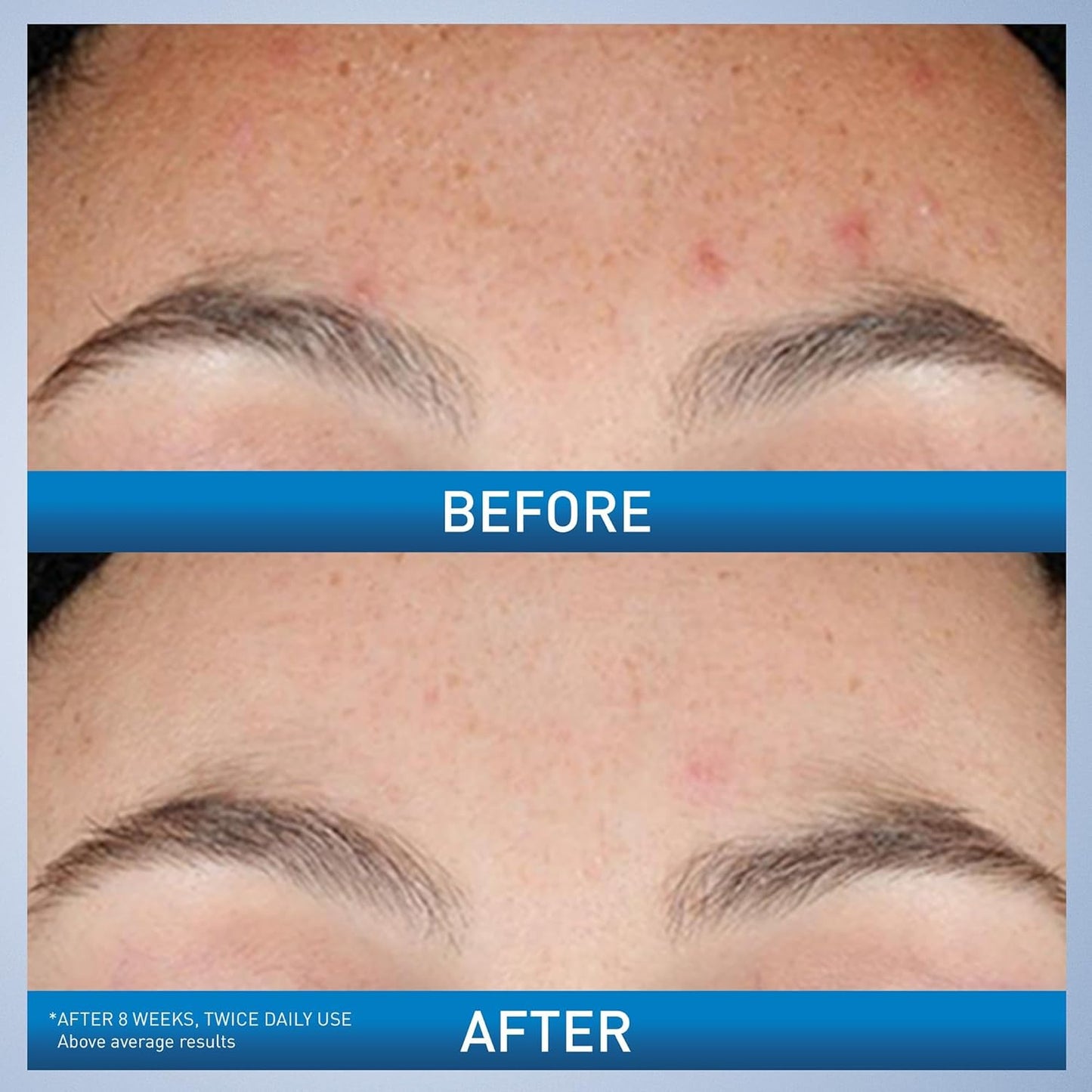 CeraVe Resurfacing Retinol Serum – Brightening & Pore Minimizing (30 ml)