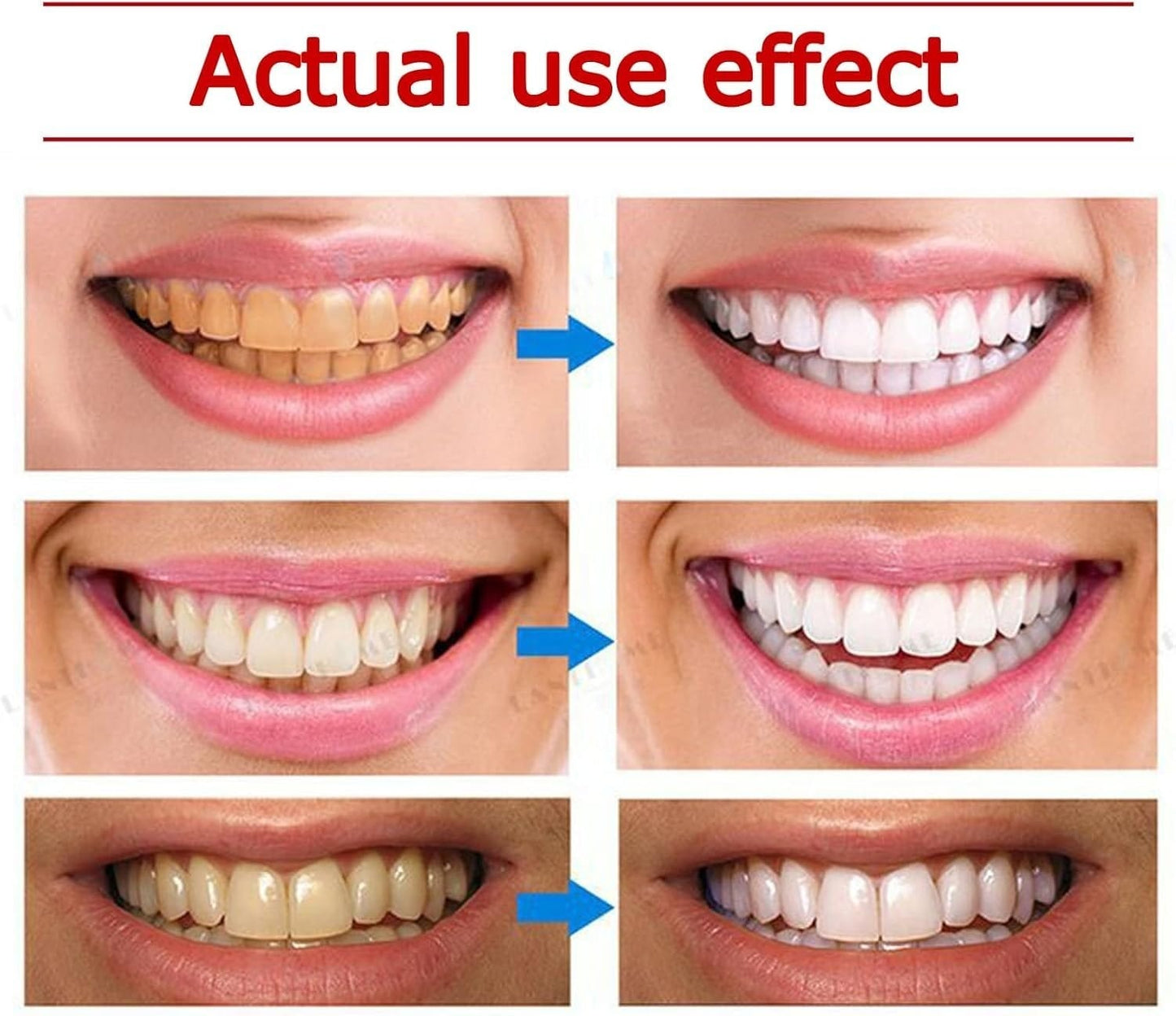 Yayashi SP4 Whitening Toothpaste 120g – Brighter Smile in Days