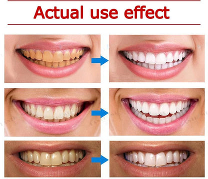 Yayashi SP4 Whitening Toothpaste 120g – Brighter Smile in Days