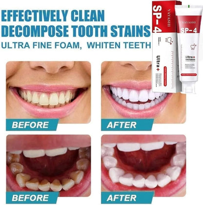 Yayashi SP4 Whitening Toothpaste 120g – Brighter Smile in Days